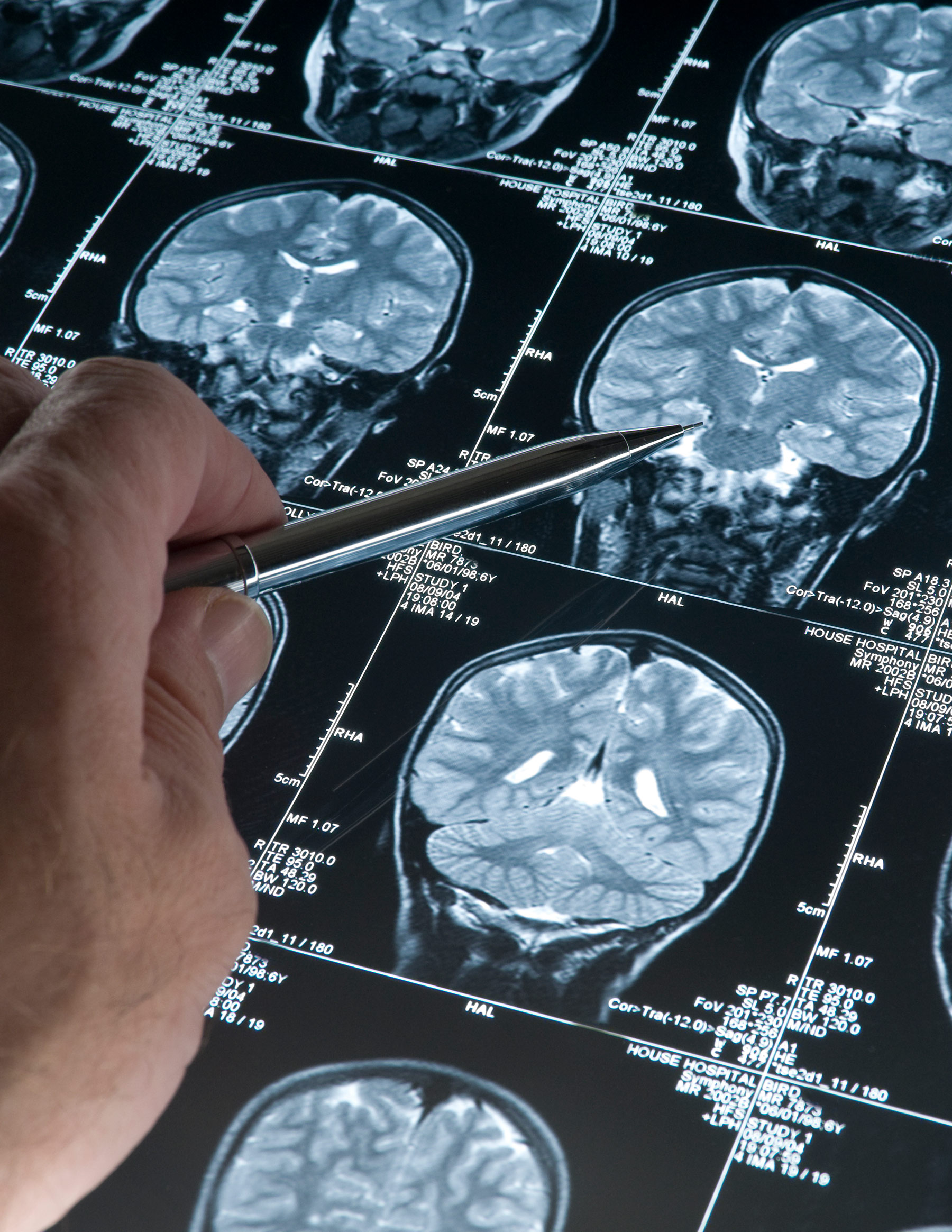 NYNAPC - boutique neurology services